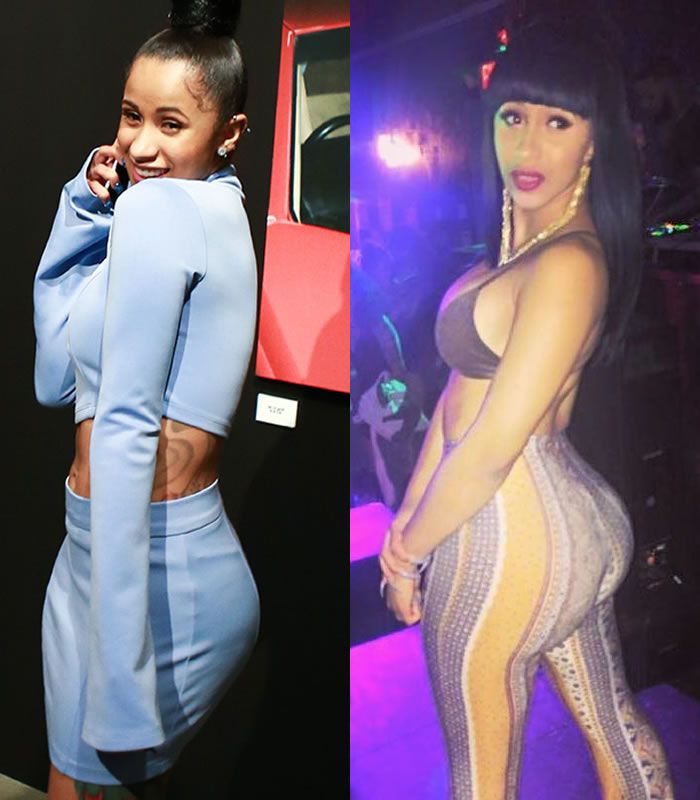 Cardi B Plastic Surgery REVEALED! (Before & After Photos 2018) | Celebrity prom photos, Cardi b, Celebrities before and after