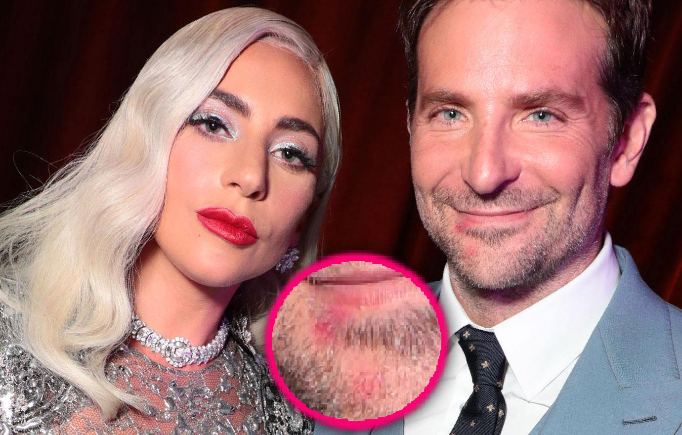 Lady Gaga's Lipstick Seen On Bradley Cooper's Mouth